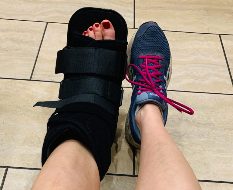 Sprained-Ankle-768x627.jpg
